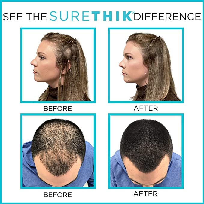 SureThik Hair Thickening Fibers - Natural - For Thicker Looking Hair - Building Fibers - 30 gm (Dark Brown)