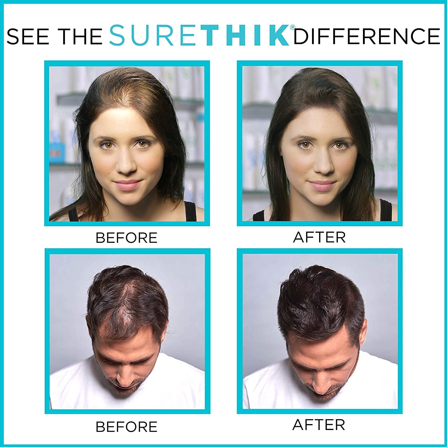 SureThik Hair Thickening Fibers - Natural - For Thicker Looking Hair - Building Fibers - 30 gm (Dark Brown)