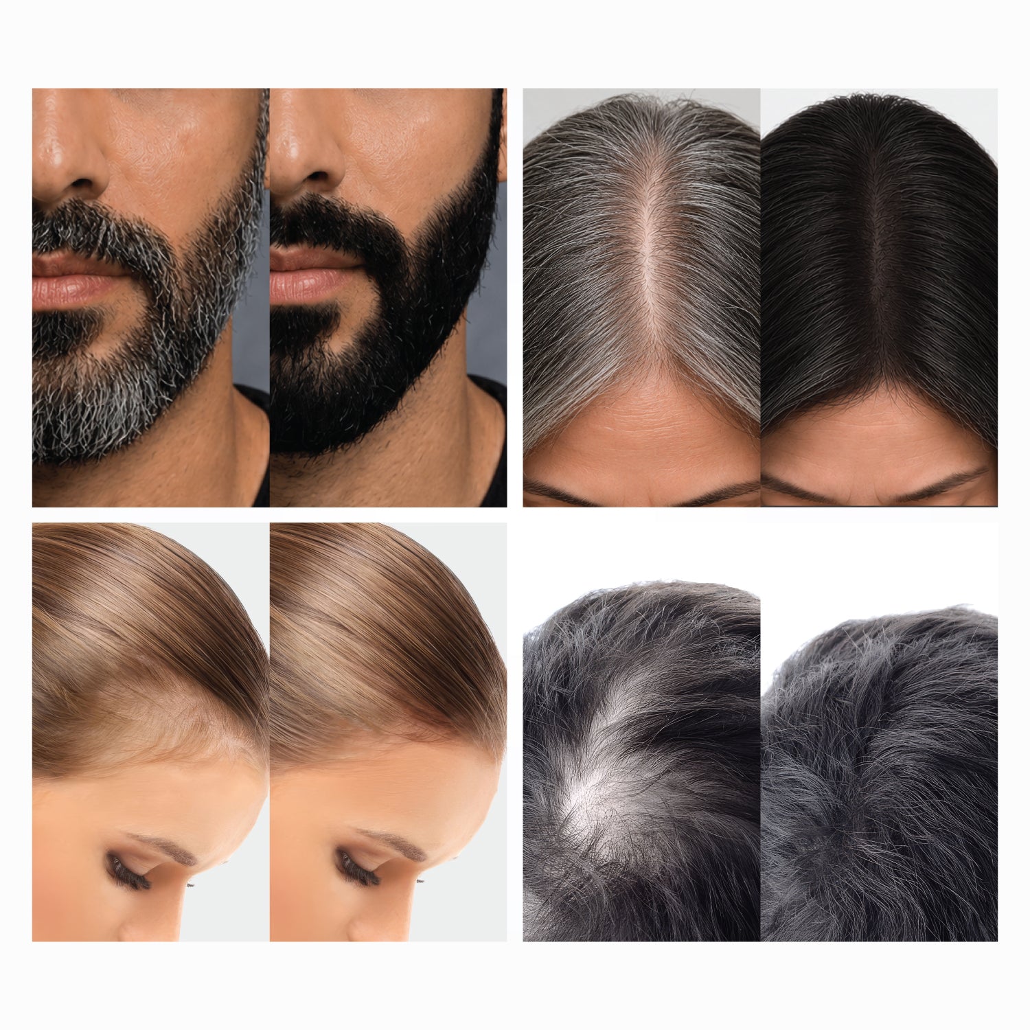 DHI Hair Press Powder - Instant Natural Grey Coverage, Hairline & Beard Filler, Matte Finish, Black, 4 gms